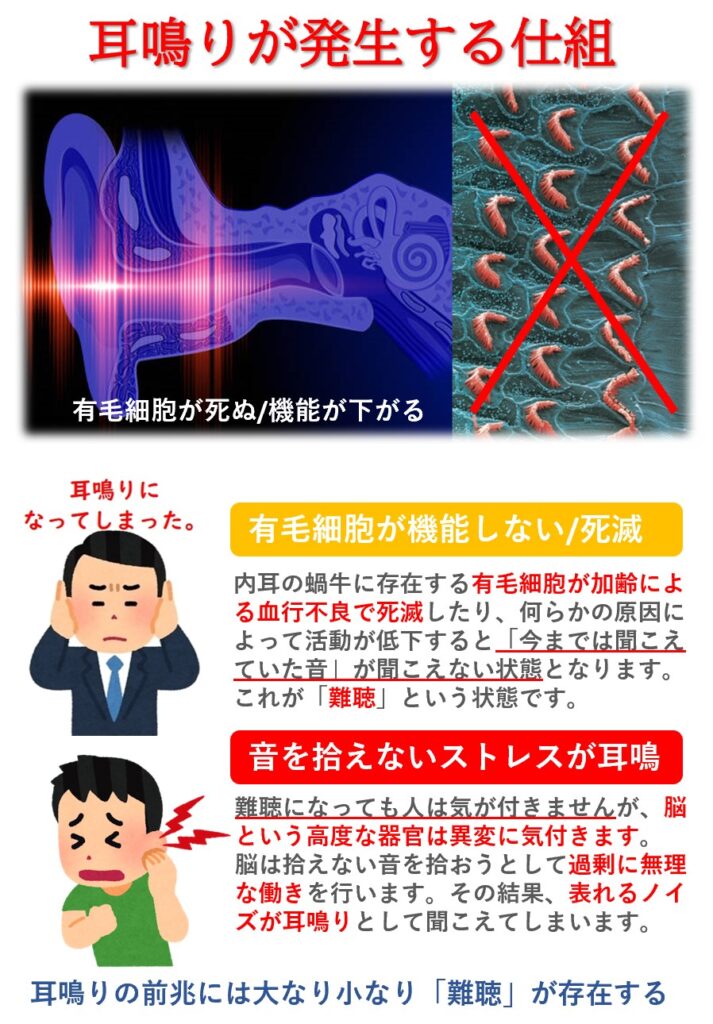 耳鳴りの仕組み：音を伝える有毛細胞が死んでしまうと今まで聞こえていた音が脳に伝達されない「難聴」になります。この状態が脳を興奮に導きノイズ（耳鳴り）を引き起こすことに繋がります。